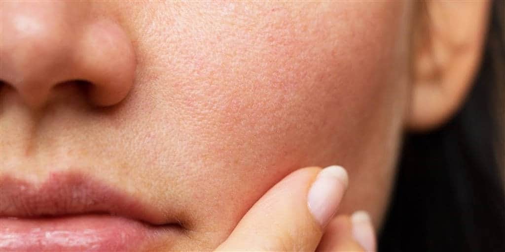 5 Cara Menetralkan Wajah Sebelum Ganti Skincare - Pinhome